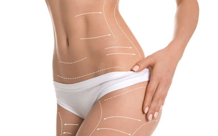 Wyszczuplenie last second