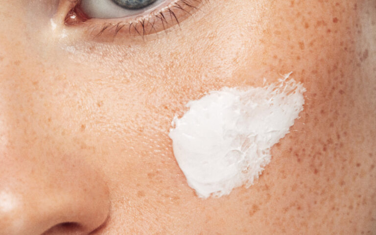 Przebarwienia i plamy posłoneczne? Mamy skuteczną terapię!