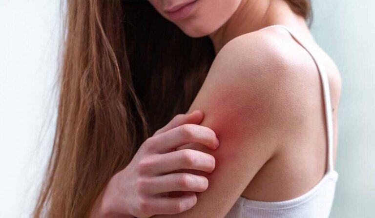 Stres i negatywne emocje a kondycja naszej skóry